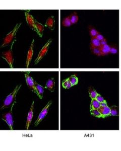 Millipore Anti-Akt/Pkb Antibody, Ph Domain, Clone Skb1