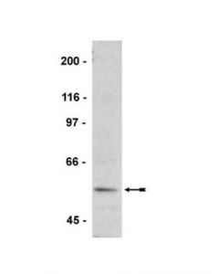 Millipore Anti-Phospho-Vasp (Ser239) Antibody, Clone 16c2