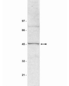 Millipore Anti-Suv39h1 Antibody, Clone Mg44