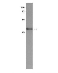 Millipore Anti-Cugbp1 Antibody, Clone 3b1