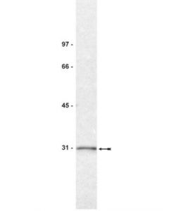 Millipore Anti-14-3-3sigma Antibody, Clone Cs112-2a8