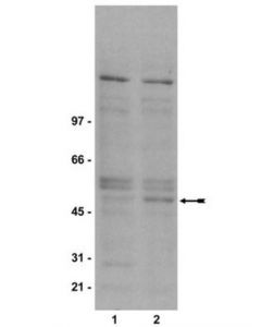 Millipore Anti-Phospho-Gsk3beta (Ser9) Antibody, Clone 2d3