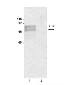 Millipore Anti-Tyrosinase Antibody, Clone T311