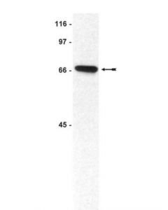 Millipore Anti-Chk2 Antibody, Clone 7