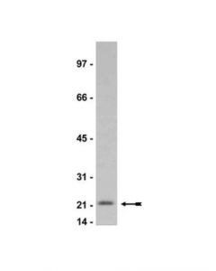 Millipore Anti-P21/Waf1/Cip1 Antibody, Clone Cp74