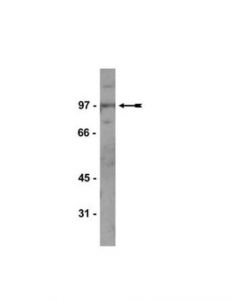Millipore Anti-Kaiso Antibody, Clone 6f