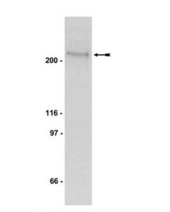 Millipore Anti-Phospho-Acetyl Coa Carboxylase (Ser79) Antibody, Clone