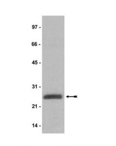 Millipore Anti-Ubiquityl-Histone H2a Antibody, Clone E6c5