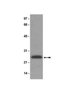 Millipore Anti-Hp1gamma Antibody, Clone 42s2
