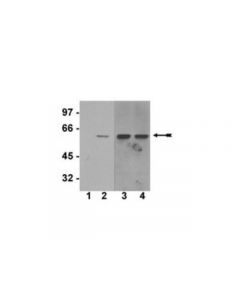 Millipore Anti-Phospho-Akt1/Pkbalpha (Ser473) Antibody, Clone Sk703,