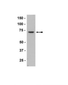 Millipore Anti-Zap-70 Antibody, Clone 1e7.2