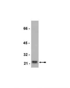 Millipore Anti-Rho (-A Antibody, -B, -C), Clone 55