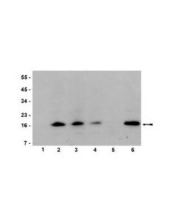Millipore Anti-Trimethyl-Histone H3 (Lys36) Antibody, Clone Mc86,