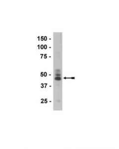 Millipore Anti-Tau (3-Repeat Isoform Rd3) Antibody, Clone 8e6/C11