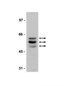 Millipore Anti-Tau (4-Repeat Isoform Rd4) Mouse Ab, 200ul