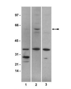 Millipore Anti-Phospho-Smad1 (Ser463/465) Antibody