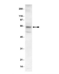 Millipore Anti-P70 S6 Kinase (S6k) Antibody
