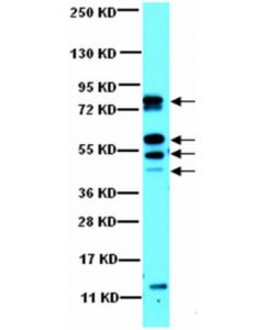 Millipore Anti-Cam Kinase Ii Antibody