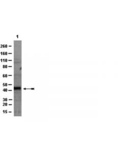 Millipore Anti-Hdac11 Antibody