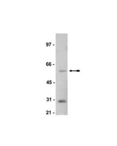 Millipore Anti-Sgk1 Antibody