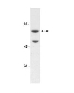 Millipore Anti-Akt3/Pkbgamma Antibody