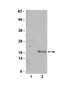 Millipore Anti-P19 Arf Antibody
