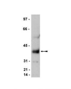 Millipore Anti-Stargazin/Cacng2 Antibody, Ct