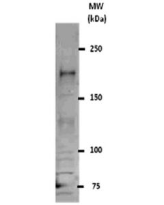 Millipore Anti-Rest Antibody; MILL-07-579