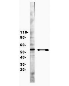 Millipore Anti-Hnf3beta/Foxa2 Antibody