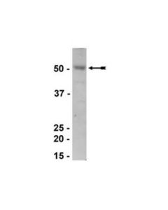 Millipore Anti-Estrogen-Related Receptor Alpha Antibody
