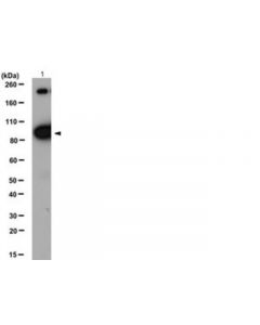 Millipore Anti-Alpha-Insulin Receptor Antibody, Beta Subunit