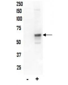 Millipore Anti-Phospho-Akt (Thr34) Antibody