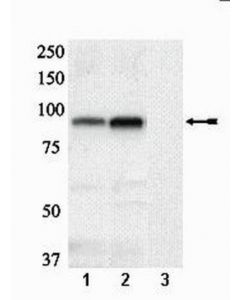 Millipore Anti-Phospho-Glycogen Synthase(Ser641/Ser645) Antibody