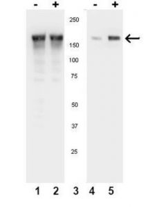 Millipore Anti-Phospho-Egfr (Tyr1086) Antibody