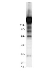 Millipore Anti-Phosphotyrosine Antibody, Clone 4g10, Agarose Conjugate