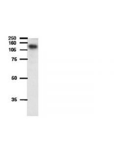 Millipore Anti-Atp-Binding Cassette Antibody  Sub-Family B (Mdr/T; MILL-AB10340