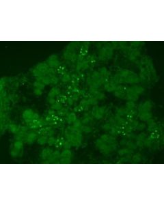 Millipore Anti-Neurogenin-3 (Rabbit) Antibody