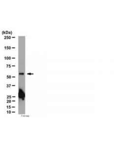 Millipore Anti-Nicotinic Acetylcholine Receptor Beta2 Antibody
