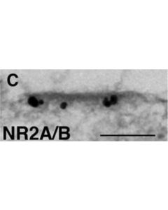 Millipore Anti-Nmdar2a&B Antibody, Pan