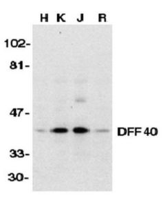 Millipore Anti-Dff40 Antibody