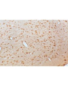 Millipore Anti-Brain Derived Neurotrophic Factor Antibody