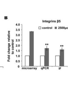 Millipore Anti-Integrin Beta5 Antibody, Ct/Cytosolic