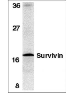 Millipore Anti-Survivin Antibody