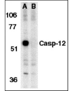 Millipore Anti-Caspase 12 Antibody, Prodomain, Aa 100-116