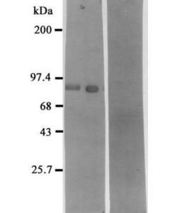 Millipore Anti-Neprilysin Antibody (Neutral Endopeptidase, Nep)