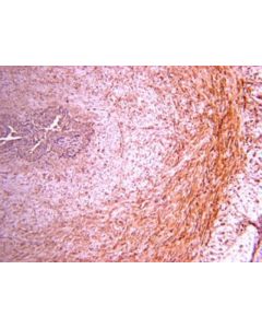 Millipore Anti-Procollagen Type Iii Piiinp Antibody
