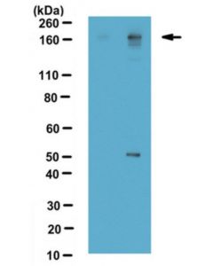 Millipore Anti-Dimethyl-Baf155 Antibody (Arg1064, Asymetrically Di-Methylated)
