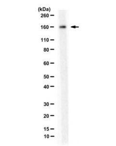 Millipore Anti-Fanci Antibody, (G4270)