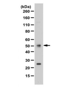 Millipore Anti-Foxl2 Antibody