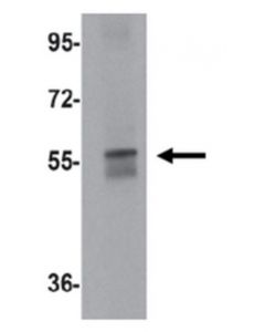 Millipore Anti-Neto1 Antibody